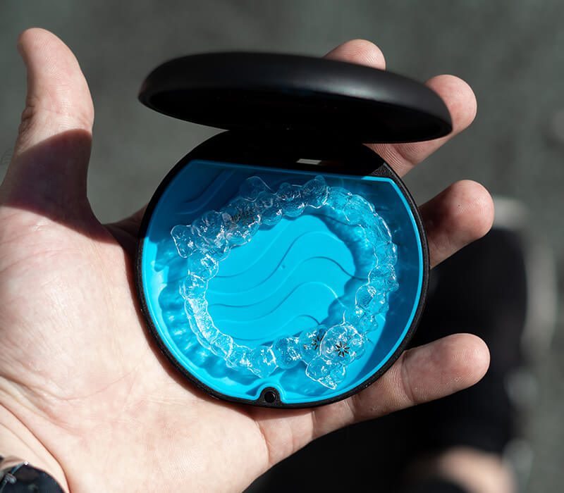 Invisalign aligners in their blue storage case